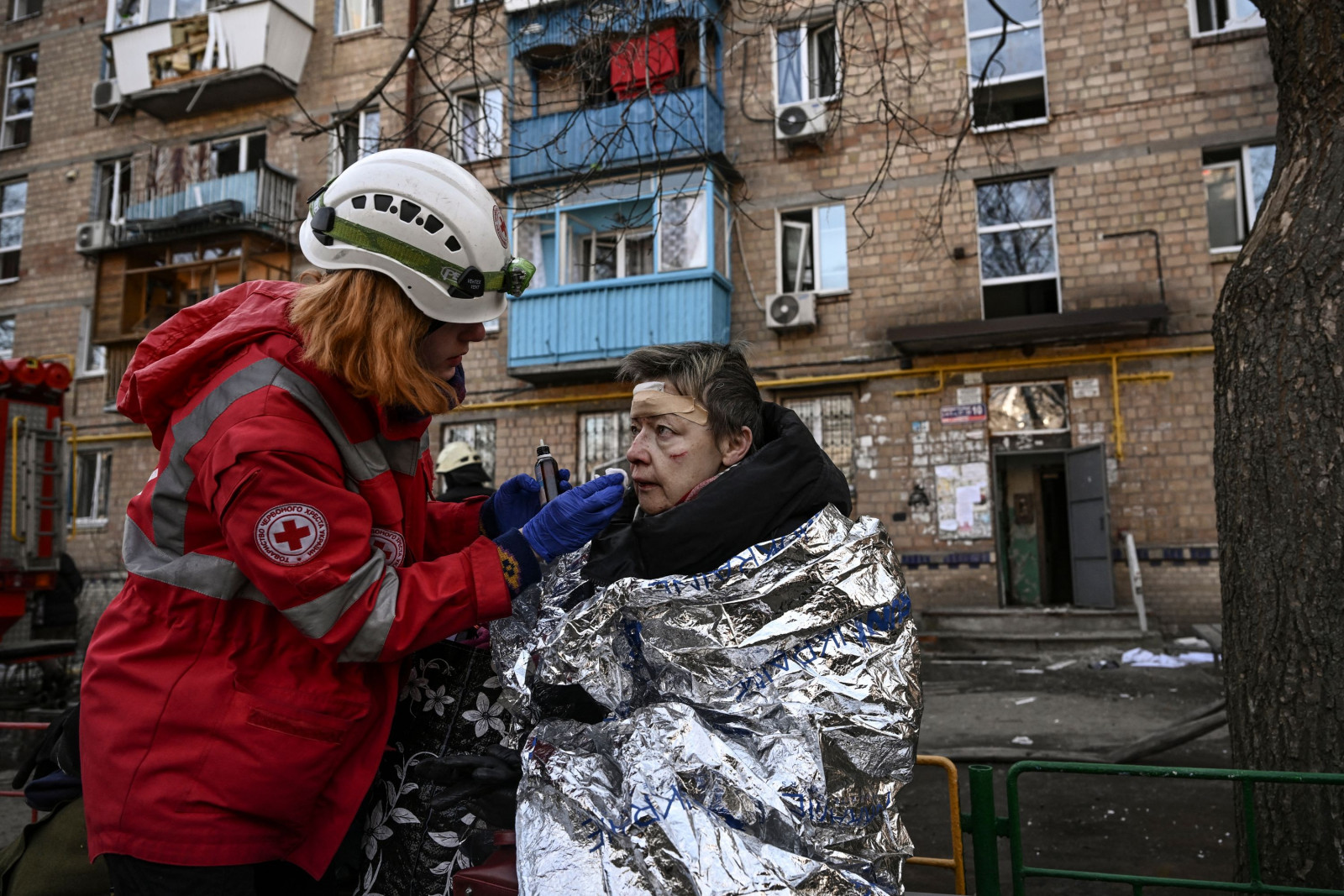 Гуравдугаар сарын 18-нд Украины Киев хотын нэгэн орон сууцны хорооллыг буудсаны дараа шархадсан эмэгтэй эмчлүүлж байна. (Emin Sansar/Anadolu Agency/Getty Images)