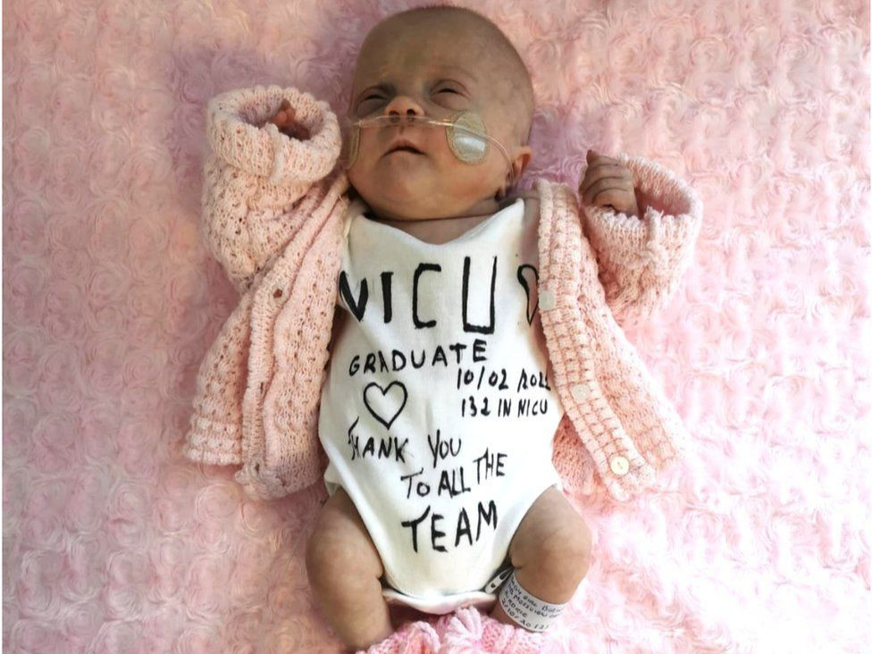 22 долоо хоногтой дутуу төрсөн бяцхан охин эмнэлгээс гарчээ