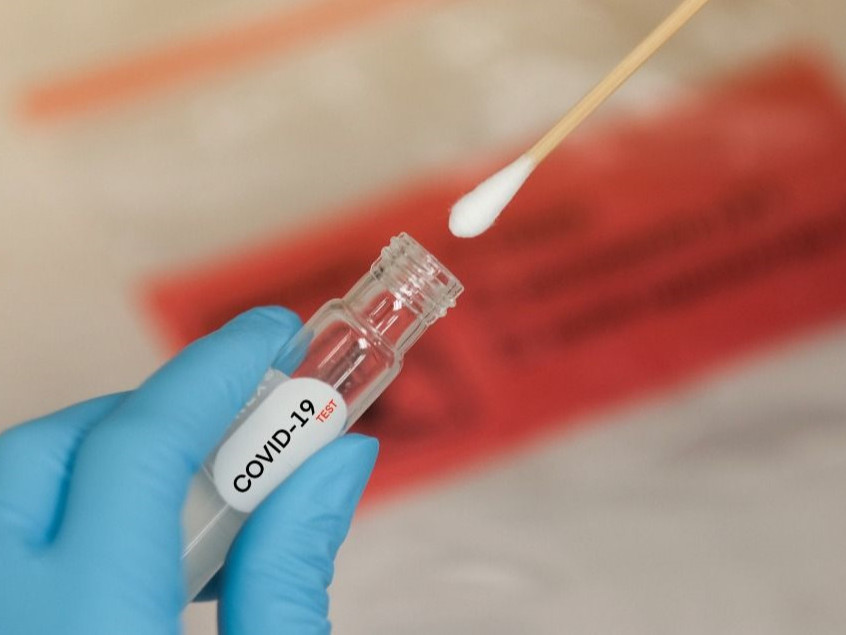 Гадаадад зорчих иргэд нислэг үйлдэхээс 24-48 цагийн өмнө PCR шинжилгээг төлбөртэй өгнө
