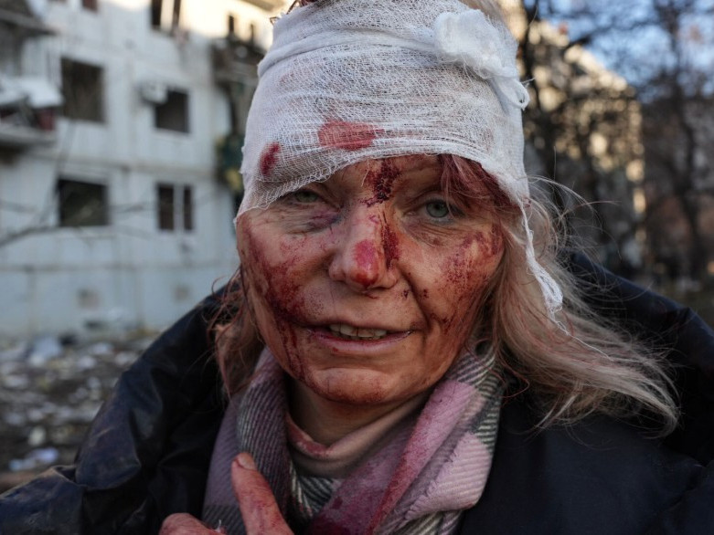 ФОТО: ОХУ Украин руу дайрсны дараах сэтгэл сэрдхийм зургуудыг нийтэлжээ