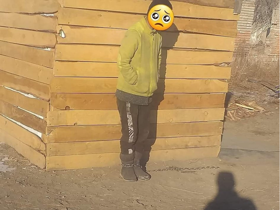 Эгч нь сэтгэцийн өвчтэй дүүгээ "гэрээсээ төөрөөд алга болох вий" хэмээн болгоомжилж, гинжилж үлдээсэн байжээ