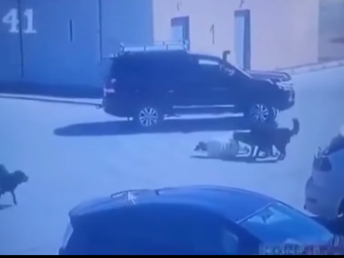 Нохдод хазуулсан эмэгтэй 10 гаруй оёдол тавиулж, эмнэлэгт хэвтэн эмчлүүлж байна 