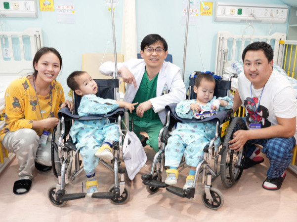 Ясны сүвний гажиг гэх оноштой ихэр монгол хөвгүүдэд БНСУ-ын эмнэлэг үнэ төлбөргүй хагалгаа хийжээ