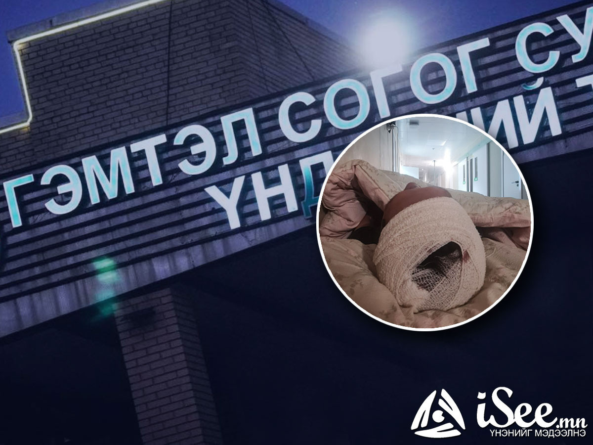 ТОДРУУЛГА: Эрэн хайж байсан хүү осолд өртөж, ГССҮТ-д ирсэн. Тухайн үед ачаалал их байсан тул коридорт хэвтүүлж байгаад тасаг руу шилжүүлсэн