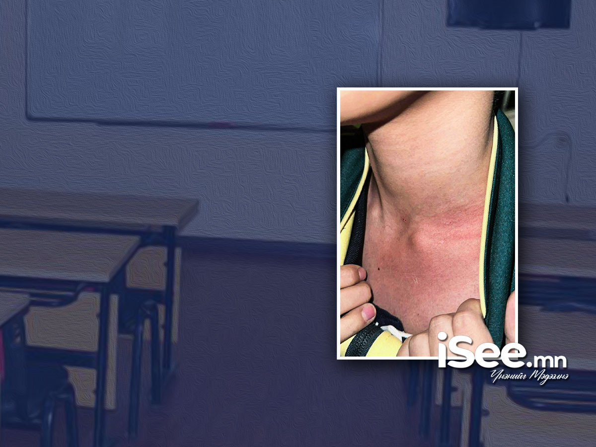 Өвөрмонголд сурдаг монгол хүүхдүүдийг багш нь зодсон хэрэгт Хөххотын консулыг анхаарч ажиллахыг хүсчээ 