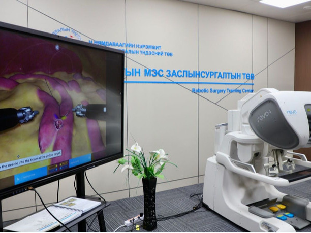 ХСҮТ робот мэс заслын эмчилгээг амжилттай нэвтрүүллээ