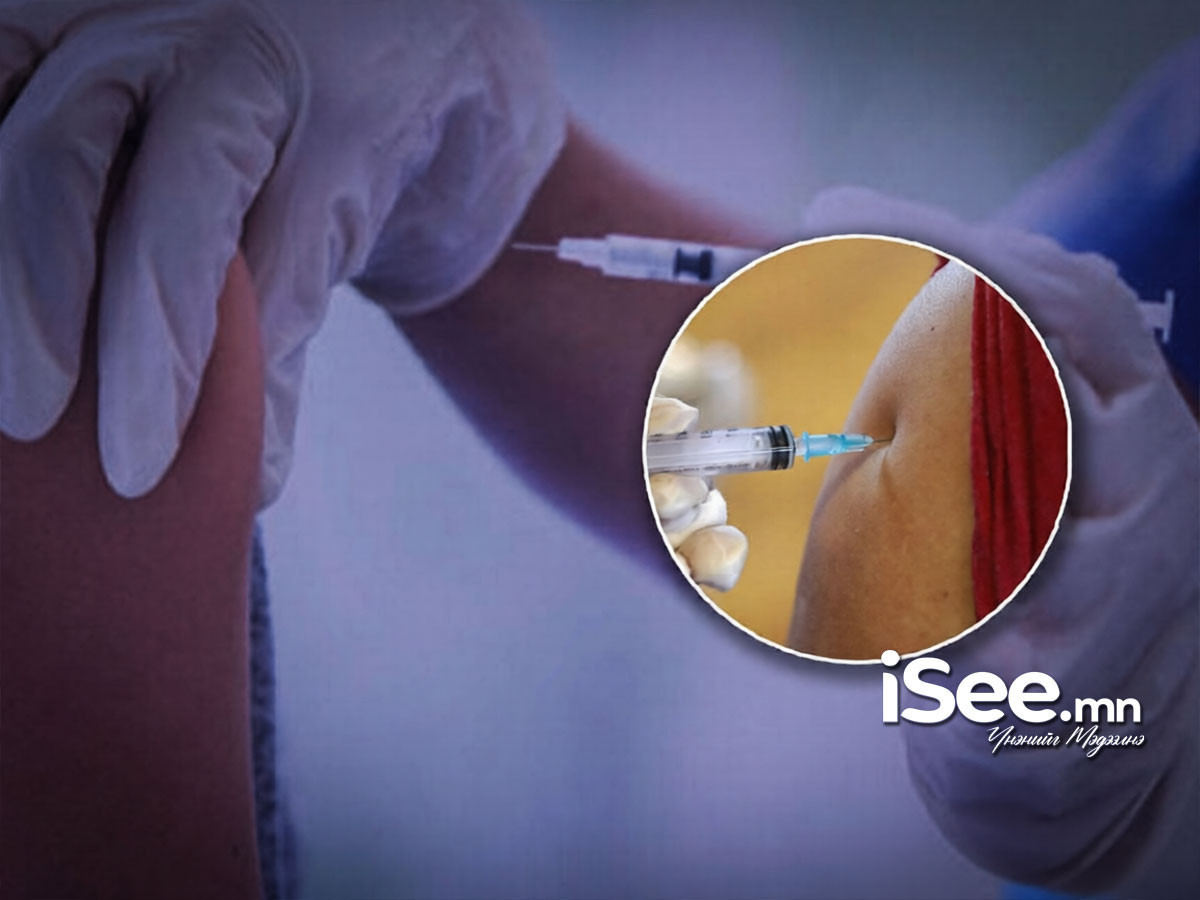 ХӨСҮТ: 10-15 насны хүүхдүүд улаанбурхан өвчнөөр өвдөж, амь нас эрсдэх эрсдэлтэй байгаа учир нэмэлт вакцинд хамруулахыг анхааруулж байна 