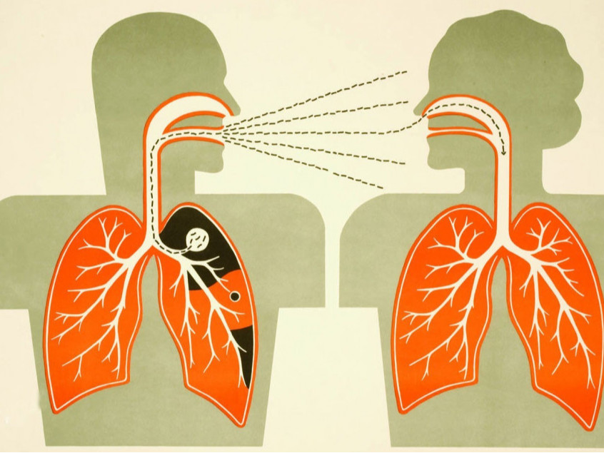 Дэлхийн сүрьеэтэй тэмцэх өдөр өнөөдөр тохиож байна 