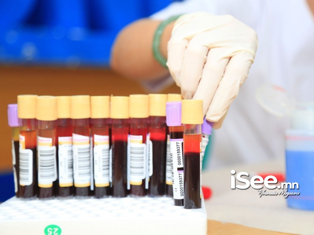 Энэ онд 30, 40 насны 20 мянган эмэгтэйг хүний папиллома вирус илрүүлэх шинжилгээнд хамруулна 