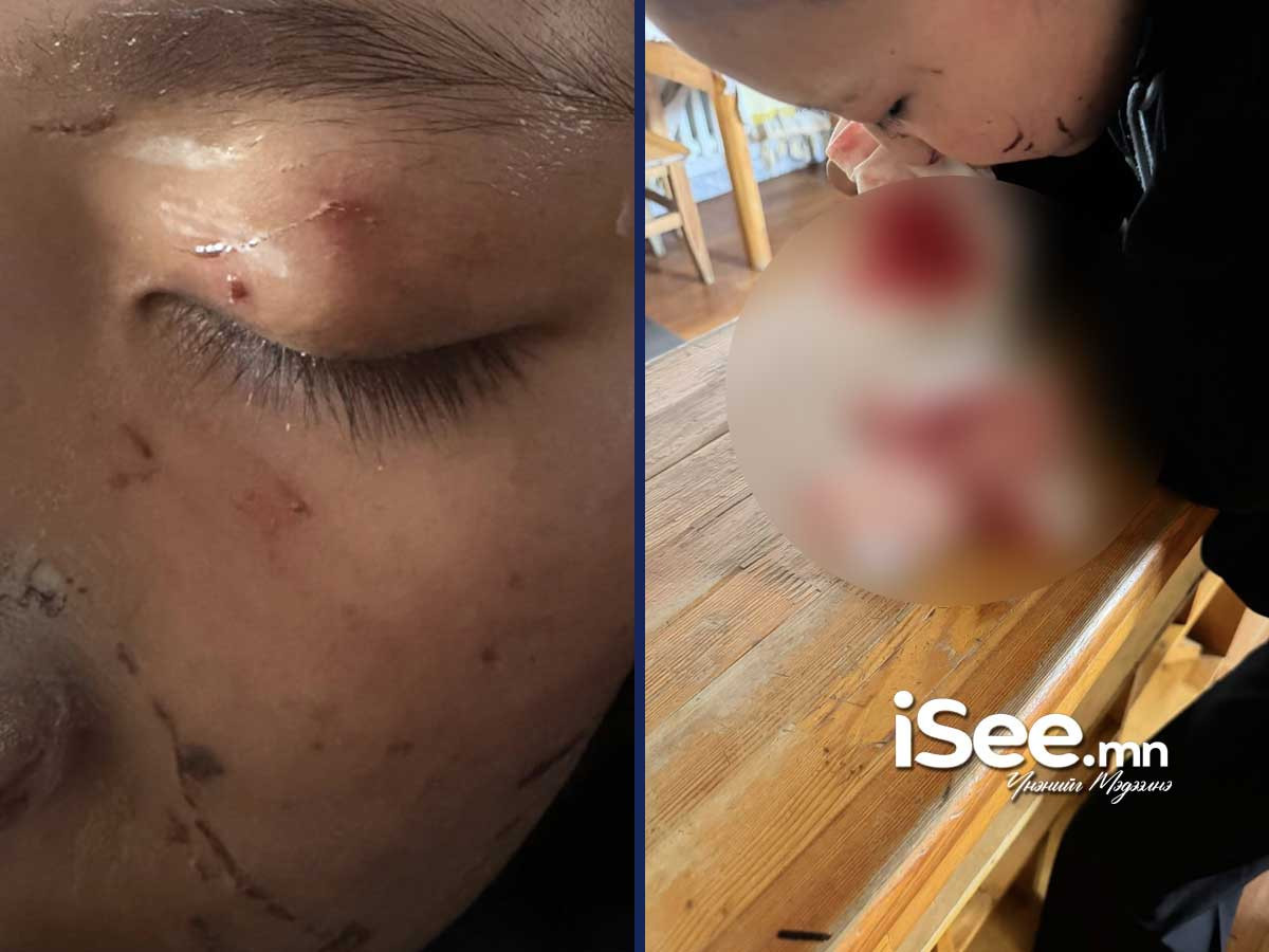 Нэгнийхээ нүүрийг маажиж, биед нь халдсан сурагчийг шалгаж, хохирогч охиныг хамгаалах байранд хүргэжээ