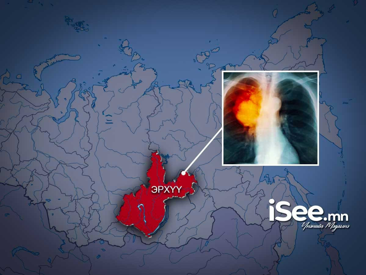 ОХУ дахь Монгол Улсын Элчин сайдын яам Эрхүү мужид зорчиж буй иргэдэд аюулгүй байдлаа анхаарахыг зөвлөлөө