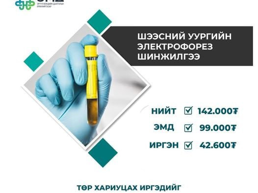 Шээсний уургийн электрофорез шинжилгээний 70 хувийг ЭМД-ын сангаас хөнгөлнө